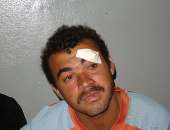 Gilberto foi agredido fisicamente por Nêgo Del