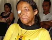Jaqueline foi agredida pelo companheiro, que foi condenado à prisão