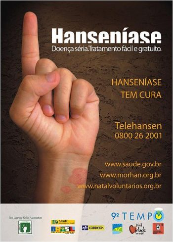 Alagoas se prepara para campanha contra hanseníase