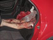 Motorista teve fratura exposta nas pernas