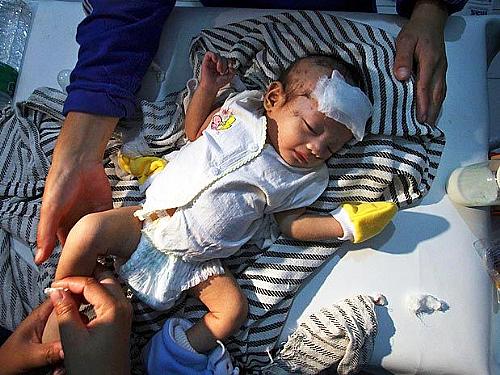 Imanuel Tegar, 2 meses, sofreu cortes no rosto e seus pulmões estão cheios de líquido, na Indonésia