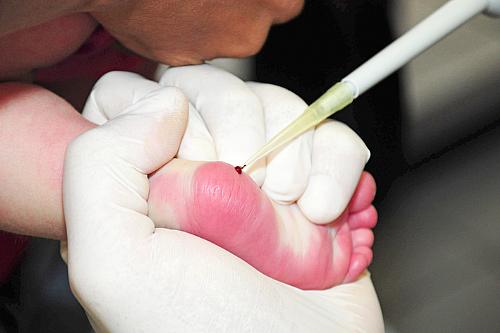 Coleta de DNA durante mutirão: importância reconhecimento de paternidade em Alagoas