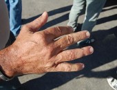 O policial mostra o dedo anelar mordido pelo acusado