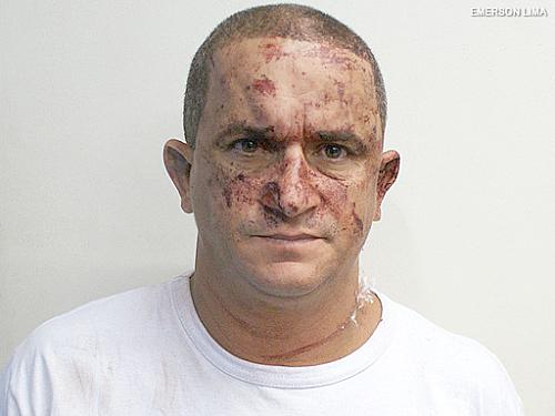 Marcelo Santos Ferraz é o responsável pelo atropelamento de dezenas de pessoas durante bloco