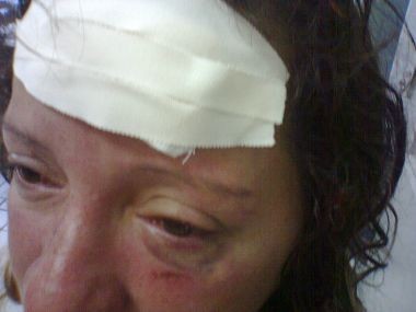 Eliane foi agredida com uma pedrada na cabeça