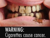 'Aviso: cigarro provoca câncer' é o que aparece