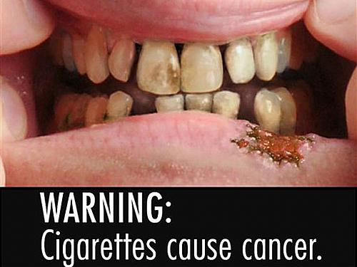 'Aviso: cigarro provoca câncer' é o que aparece