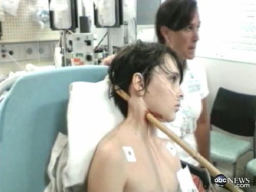 O garoto Dez Heal, de 13 anos, com a vara de bambu atravessada em seu pescoço.