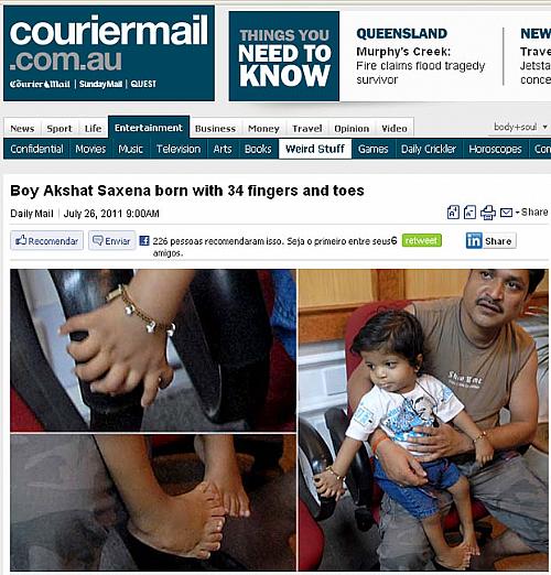 Akshat é visto com o pai antes de uma operação para amputar dedos sobressalentes