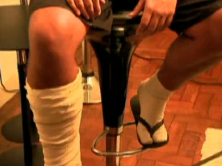 Uma das vítimas teve a perna quebrada a pontapés pelos agressores
