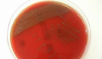 Bactéria: a Streptococcus tigurinus é uma das milhares de bactérias que vivem dentro da cavidade bucal