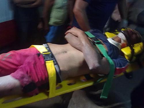 João Batista da Silva foi baleado na perna