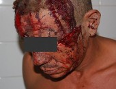 Pai e filho foram agredidos durante briga em Marechal