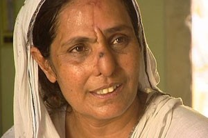 A paquistanesa Allah Rakhi, atacada pelo marido há