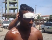Maciel Soares foi preso após acidente