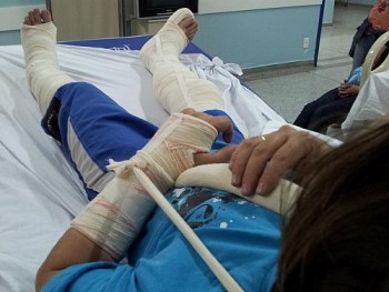 Homem teve pernas e o braço imobilizados após salvar a esposa de um assalto