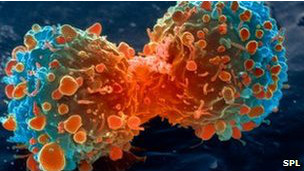 A pesquisa mostrou resultados em um determinado tipo de câncer de pulmão