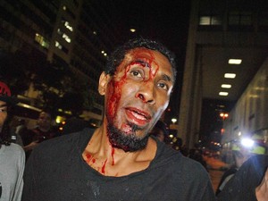 Manifestante é ferido no Rio de Janeiro