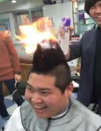 Jovem ficou com a cabeça em chamas pouco antes de raspar o cabelo em brincadeira com os amigos