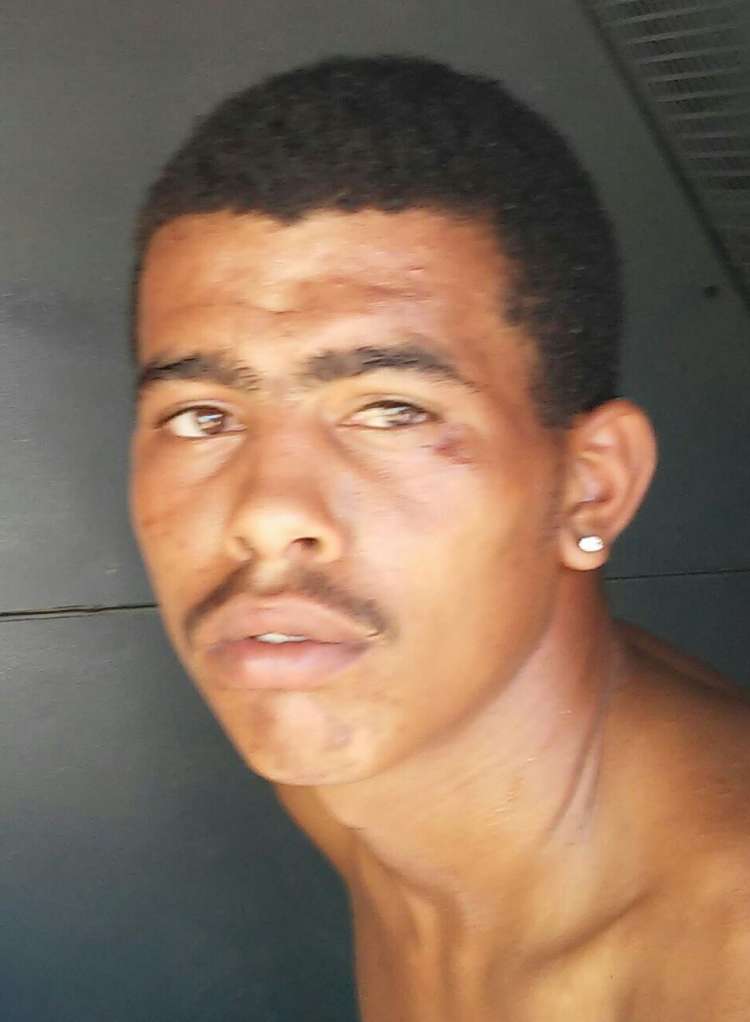 Jadson Duarte da Costa, 20, vulgo “Boi Doido” é acusado de vários crimes na região. 