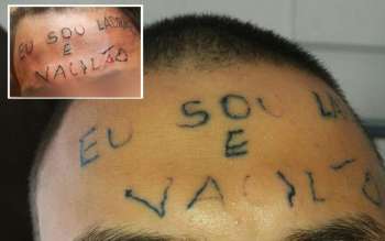 Adolescente tatuagem na testa passou por primeira sessão para retirada da frase; compare