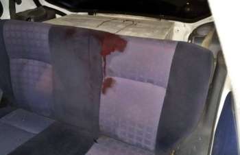O adolescente foi atingido dentro de carro, em Penedo.